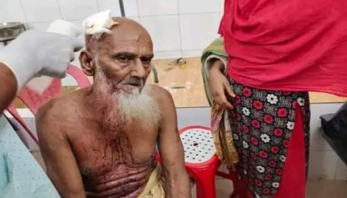 পাবনার সাঁথিয়ায় ছেলের লোহার রডের আঘাতে বৃদ্ধ পিতা আহত