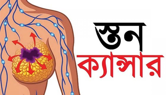 স্তন ক্যানসার নির্ণয়ে সহায়তা করবে এআই