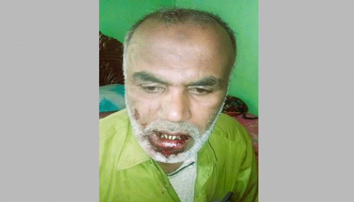 কমলগঞ্জে জোরপূর্বক জমি দখলের চেষ্টা ও হামলার অভিযোগ