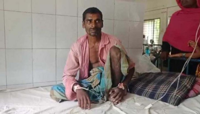 রাসেলস ভাইপারের কামড়ের পর সাপসহ হাসপাতালে কৃষক
