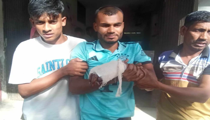 রাজশাহী বোমা বানাতে গিয়ে যুবকের কবজি বিচ্ছিন্ন