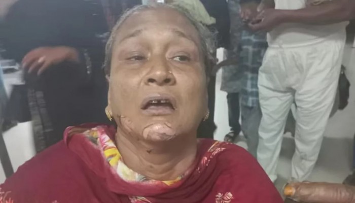 চট্টগ্রামে পেট্রোলবোমা হামলা, দগ্ধ ২