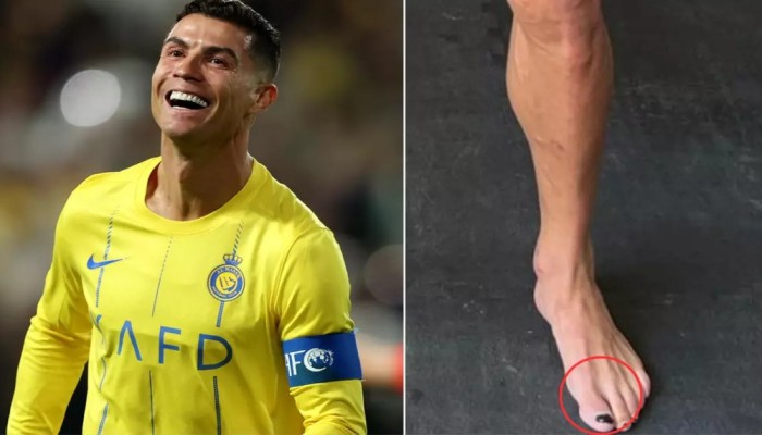 রোনালদো কেন পায়ে নেইলপলিশ লাগান