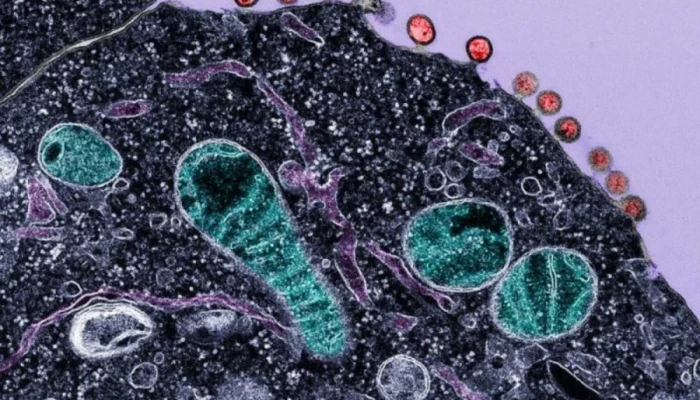 এইডস চিকিৎসায় আশার আলো, ১৮ মাস ওষুধ না খেয়েও সুস্থ ৭ রোগী