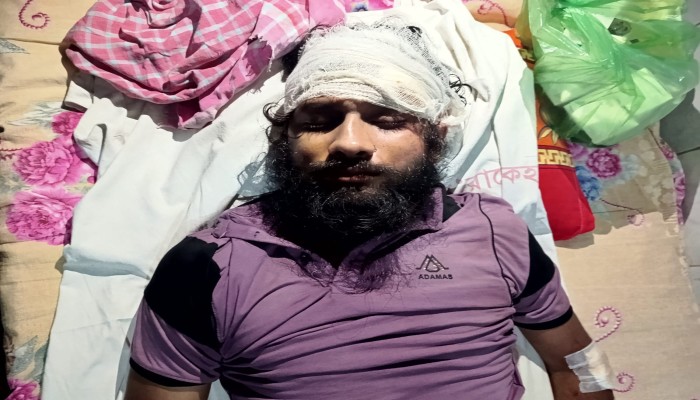 রাজশাহীতে সন্ত্রাসী হামলায় গুরুতর আহত সাংবাদিক সম্রাট, হাসপাতালে চিকিৎসাধীন