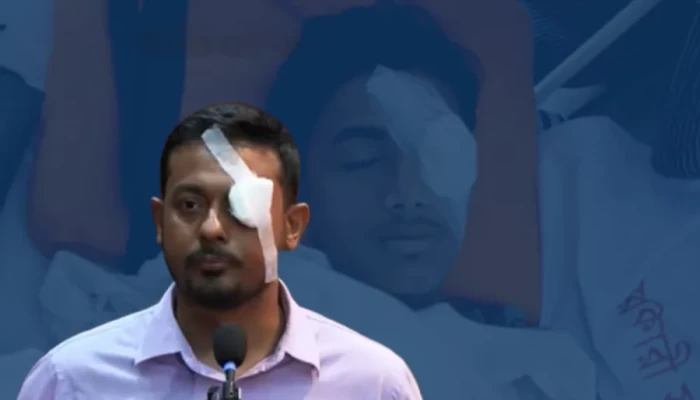 আহত আলিফের প্রতি সহমর্মিতা জানিয়ে চোখে ব্যান্ডেজ পরে বক্তব্য দিলেন পাটওয়ারী